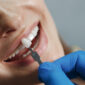 dentist whiting teeth 85x85