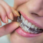 woman wearing orthodontic silicone invisible braces 85x85